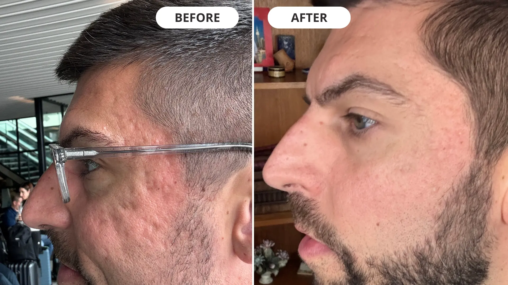 Clearer, calmer, healthier skin