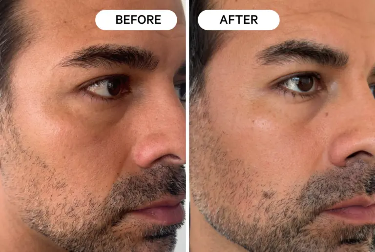 Sun spots disappeared completely