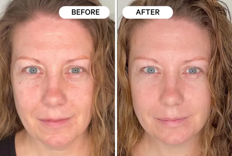 Incredible transformation