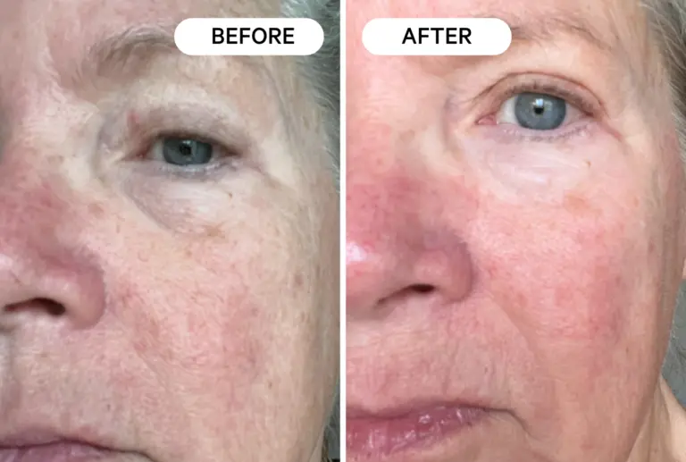 Visible results fast