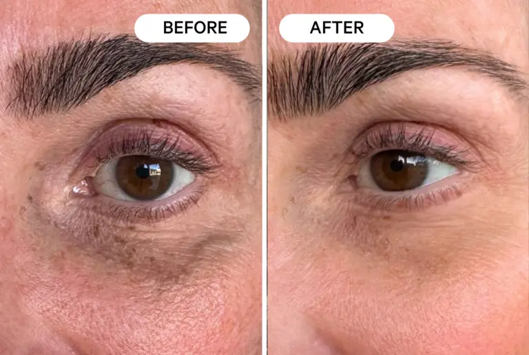 Med Spa Results at Home!